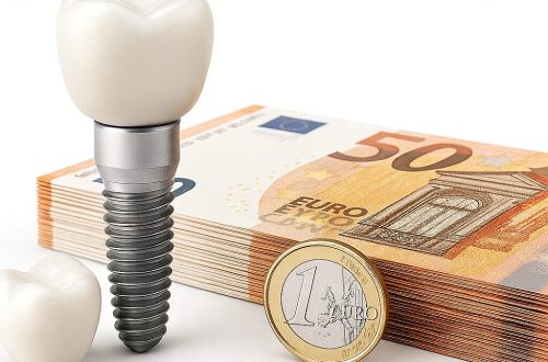 Dental implant and crown positioned beside neatly stacked 50-euro notes, representing the cost of dental implant treatment.