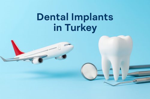 Airplane flying toward a large white tooth surrounded by dental tools and a toothbrush on a blue background, symbolizing dental tourism for implants in Turkey.