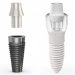Comparative diagram showing the difference between a two-piece titanium implant (dark grey, modular) and a one-piece zirconia ceramic implant (white, monolithic) set against a white background