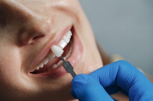 dentist whiting teeth, same-day implants